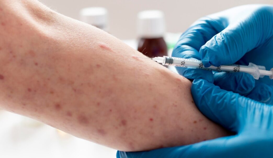 Confirman caso de sarampión en escuela pública de Puebla