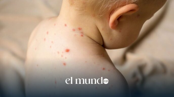 Sarampión en la CDMX: confirman segunda muerte y más de 576 casos